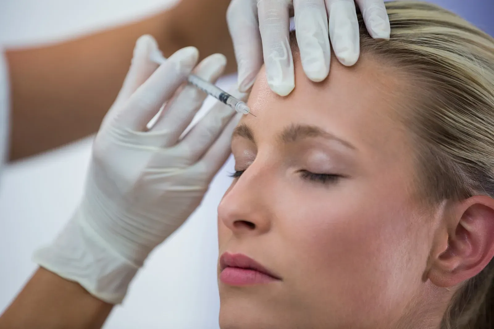 Aplicação de toxina botulínica (botox) na Clínica Dra. Simoni Bett, Joinville