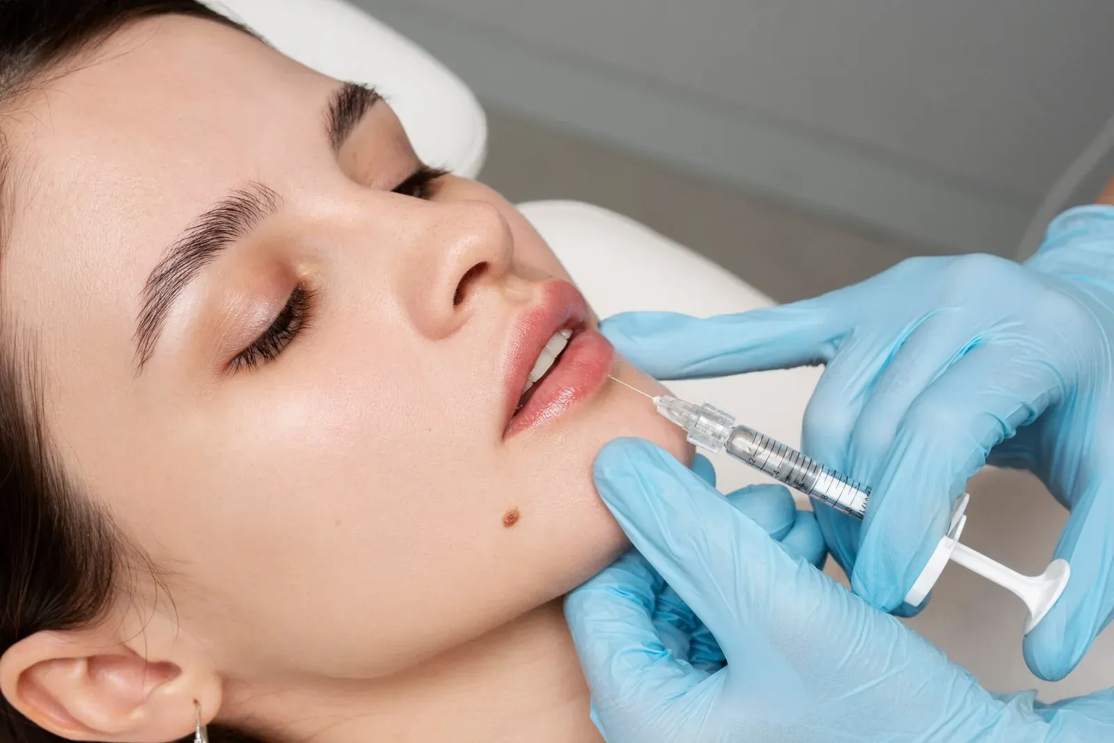 Aplicação de preenchimento como parte da harmonização facial na Clínica Dra. Simoni Bett, Joinville