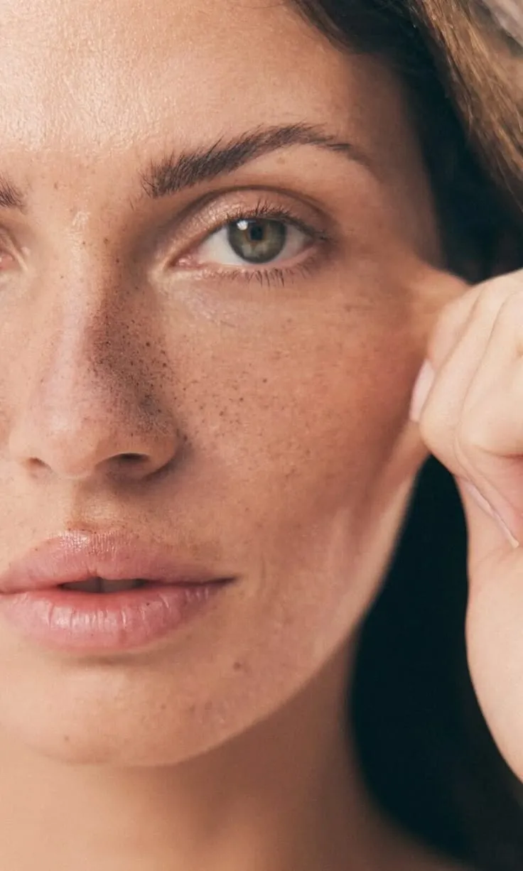 Mulher com sardas tocando o rosto, pele com textura natural, cuidado facial na Clínica Dra. Simoni Bett, Joinville