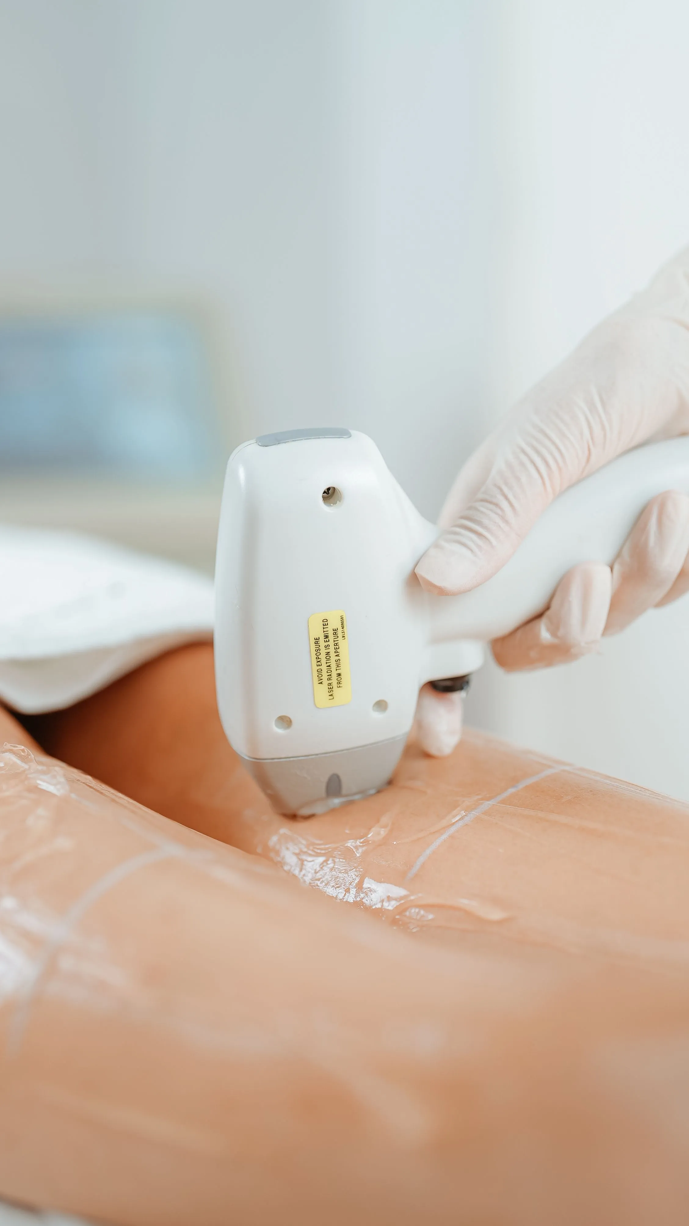 Aplicação de depilação a laser em clínica de estética