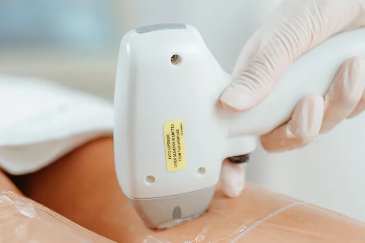 Depilação a Laser em Joinville: Como Funciona e Quantas Sessões - Blog Clínica Dra. Simoni Bett