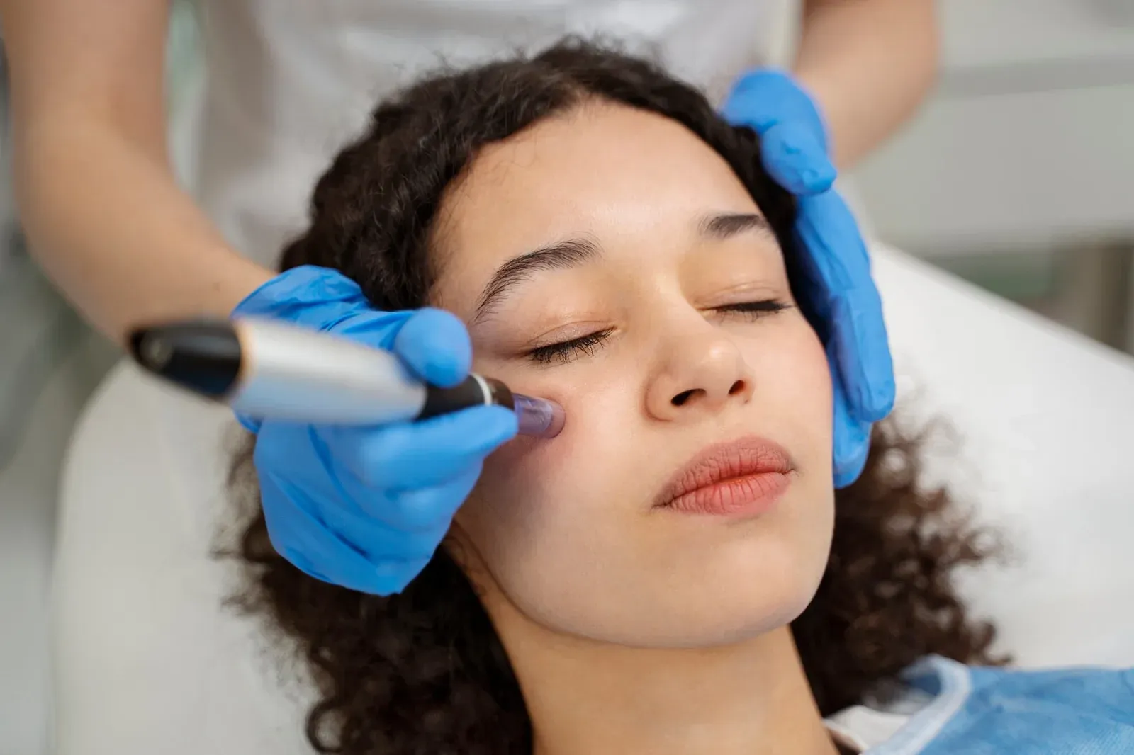 Aplicação de microagulhamento com dermapen na Clínica Dra. Simoni Bett, Joinville