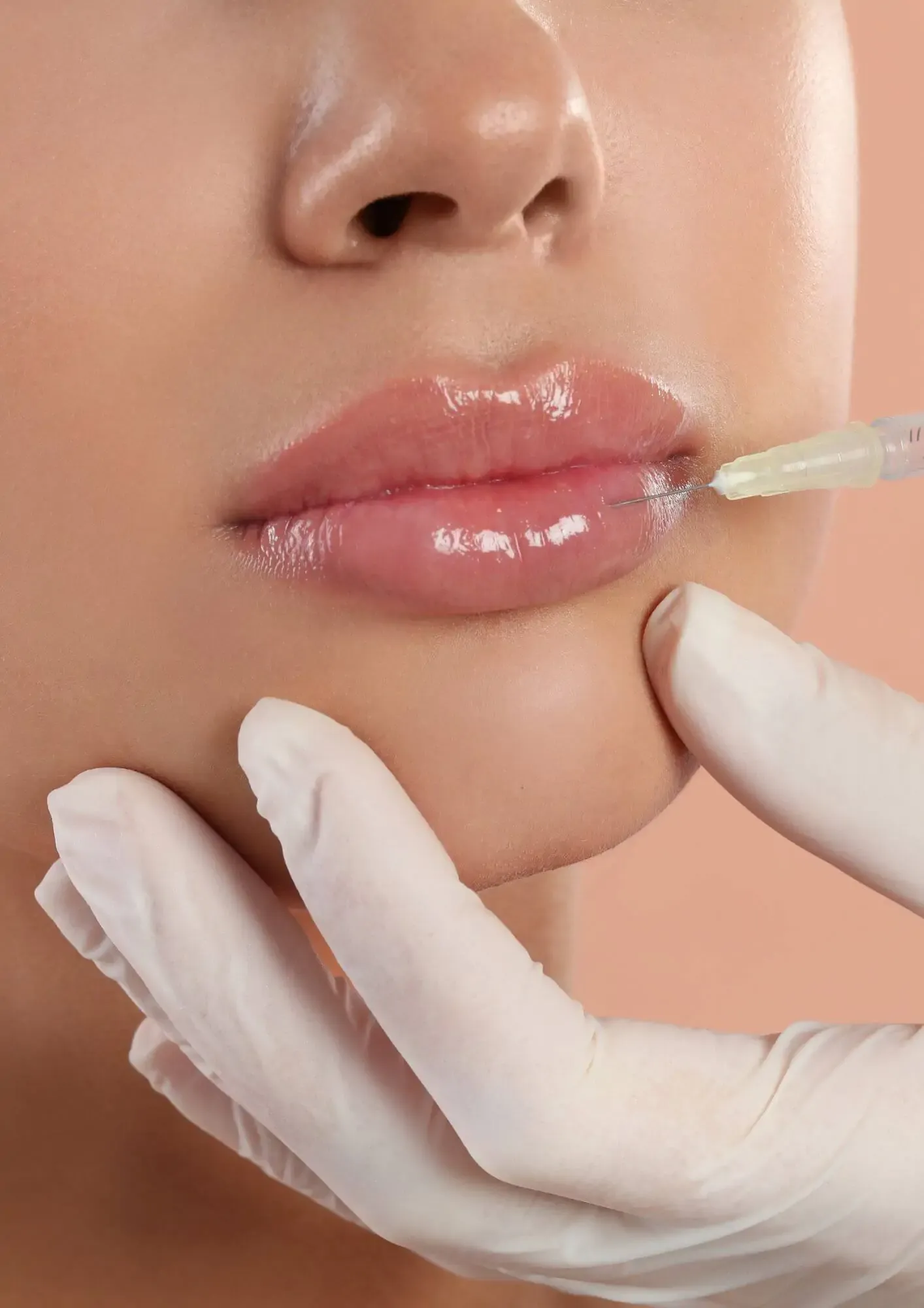 Aplicação de preenchimento nos lábios como parte da harmonização facial na Clínica Dra. Simoni Bett, Joinville