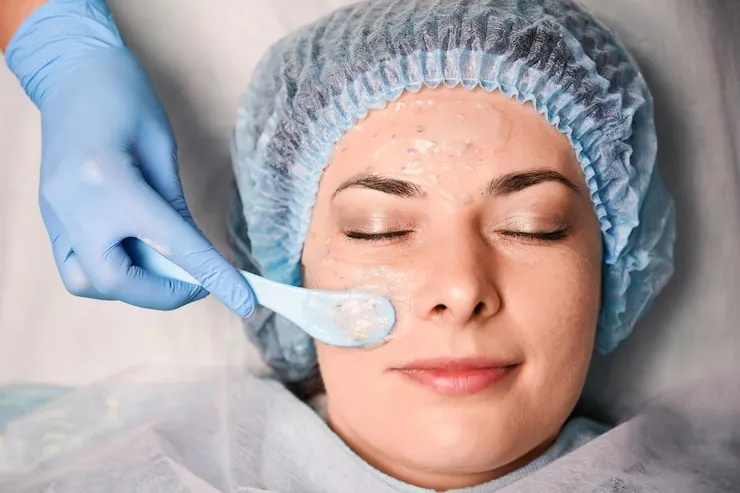 Tratamento para Melasma em Joinville: Como Clarear Manchas na Pele - Blog Clínica Dra. Simoni Bett