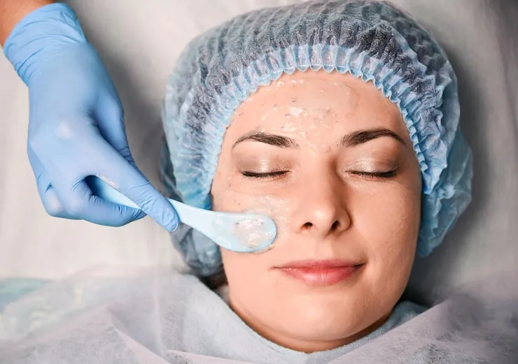 Tratamento para Melasma em Joinville: Como Clarear Manchas na Pele Tratamento facial para manchas na pele