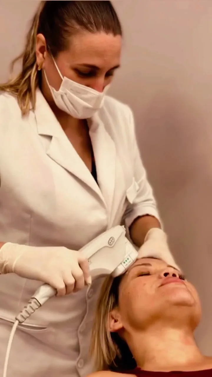 Procedimento estético facial aplicado por Simoni Bett na Clínica Dra. Simoni Bett, Joinville