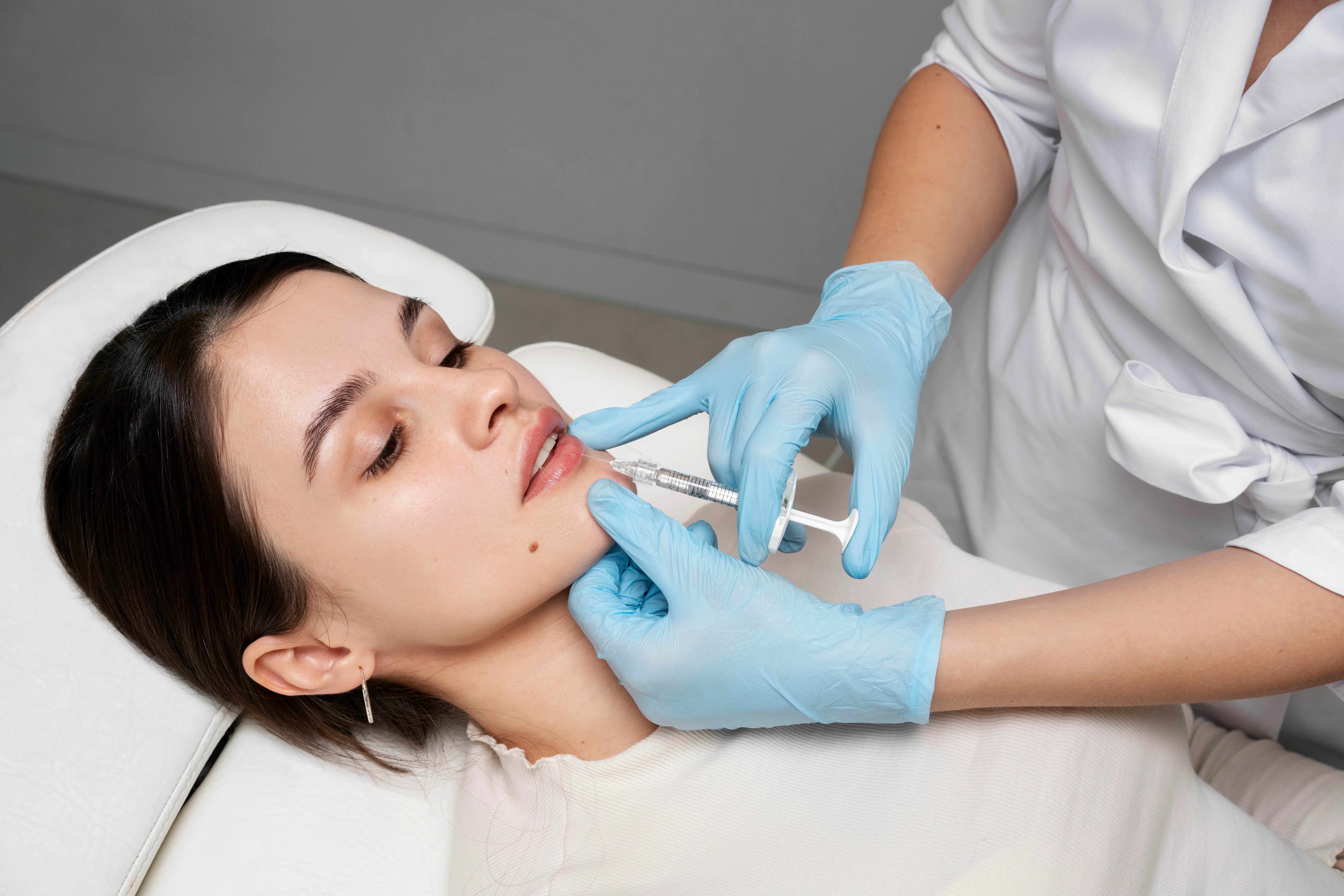 Aplicação de preenchimento labial com ácido hialurônico